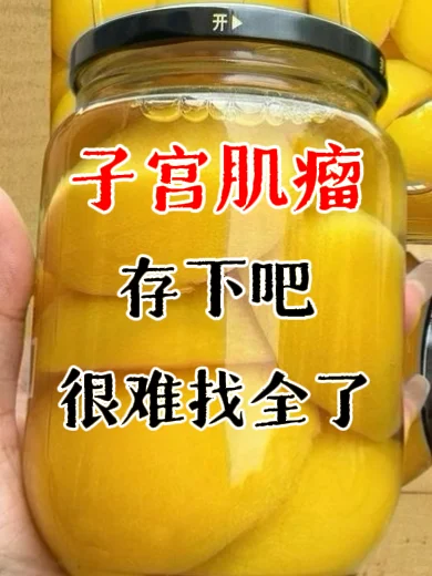 子宫肌瘤的“四大忌口”及健康饮食策略