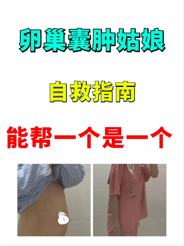 卵巢囊肿困扰？探索中医调理与辅助生殖的有效方法