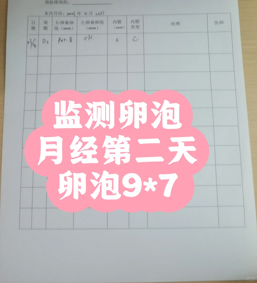 监测卵泡：月经第二天出现优势卵泡，促排卵时机与个体化方案
